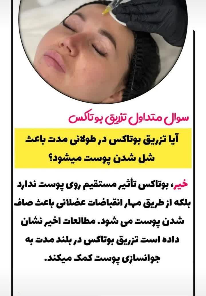 بوتاکس ژل آنزیم نخ لاغری بوتاکس 500وژل اودری350|خدمات آرایشگری و زیبایی|قم, هفت تیر|دیوار