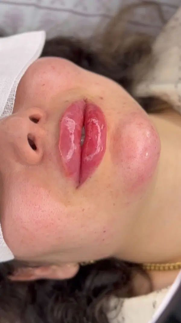 مرکز تخصصی تزریق بوتاکس فیلرگونه چشم زاویه آنزیم|خدمات آرایشگری و زیبایی|اندیشه, اندیشه فاز ۱|دیوار