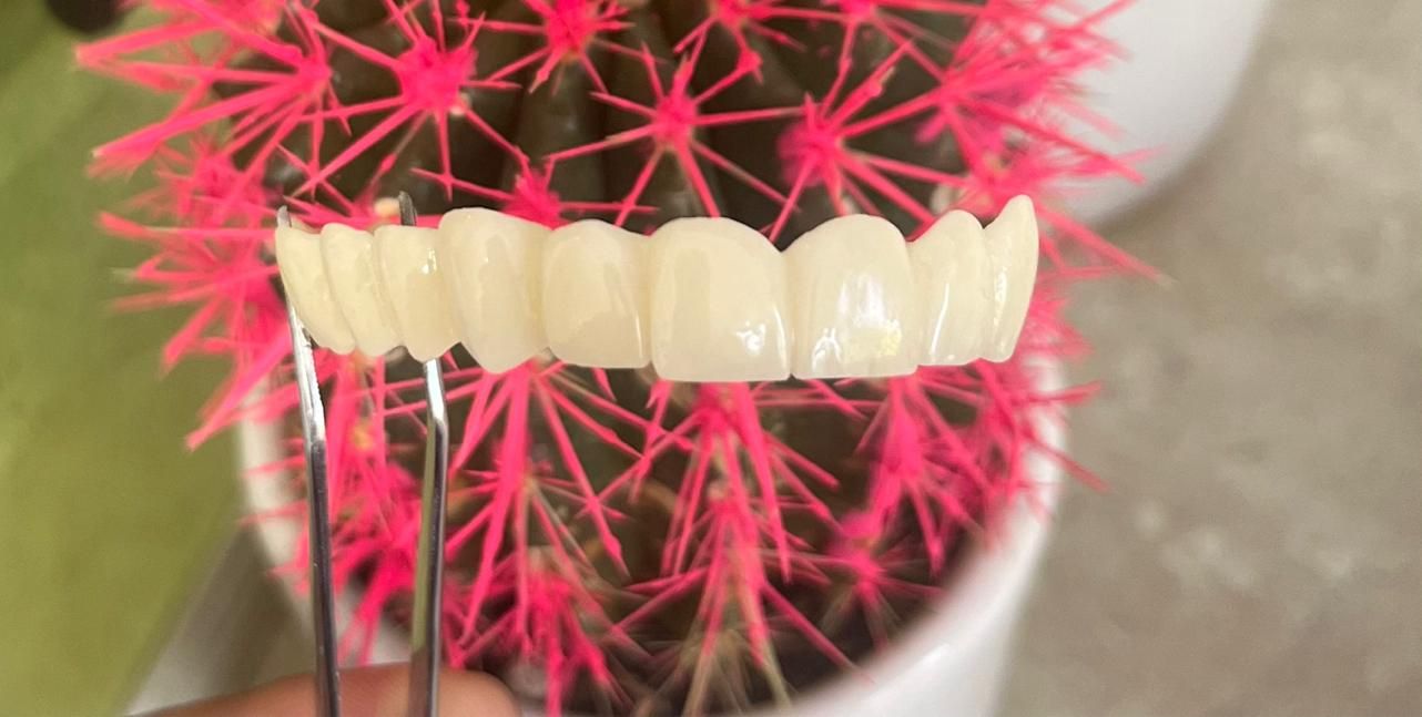 دندان سازی|خدمات آرایشگری و زیبایی|خوی, |دیوار