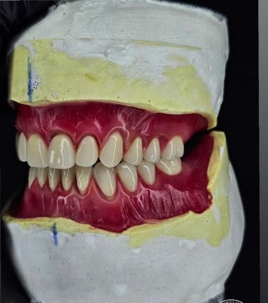 اولین و تنها مرکز دندانسازی بدون لقی در لردگان|خدمات آرایشگری و زیبایی|لردگان, |دیوار