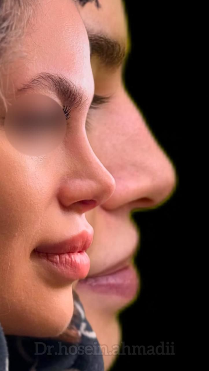 عمل جراحی بینی توسط متخصص زیباییent/ترمیم بینی|خدمات آرایشگری و زیبایی|کرج, چهارصد دستگاه|دیوار