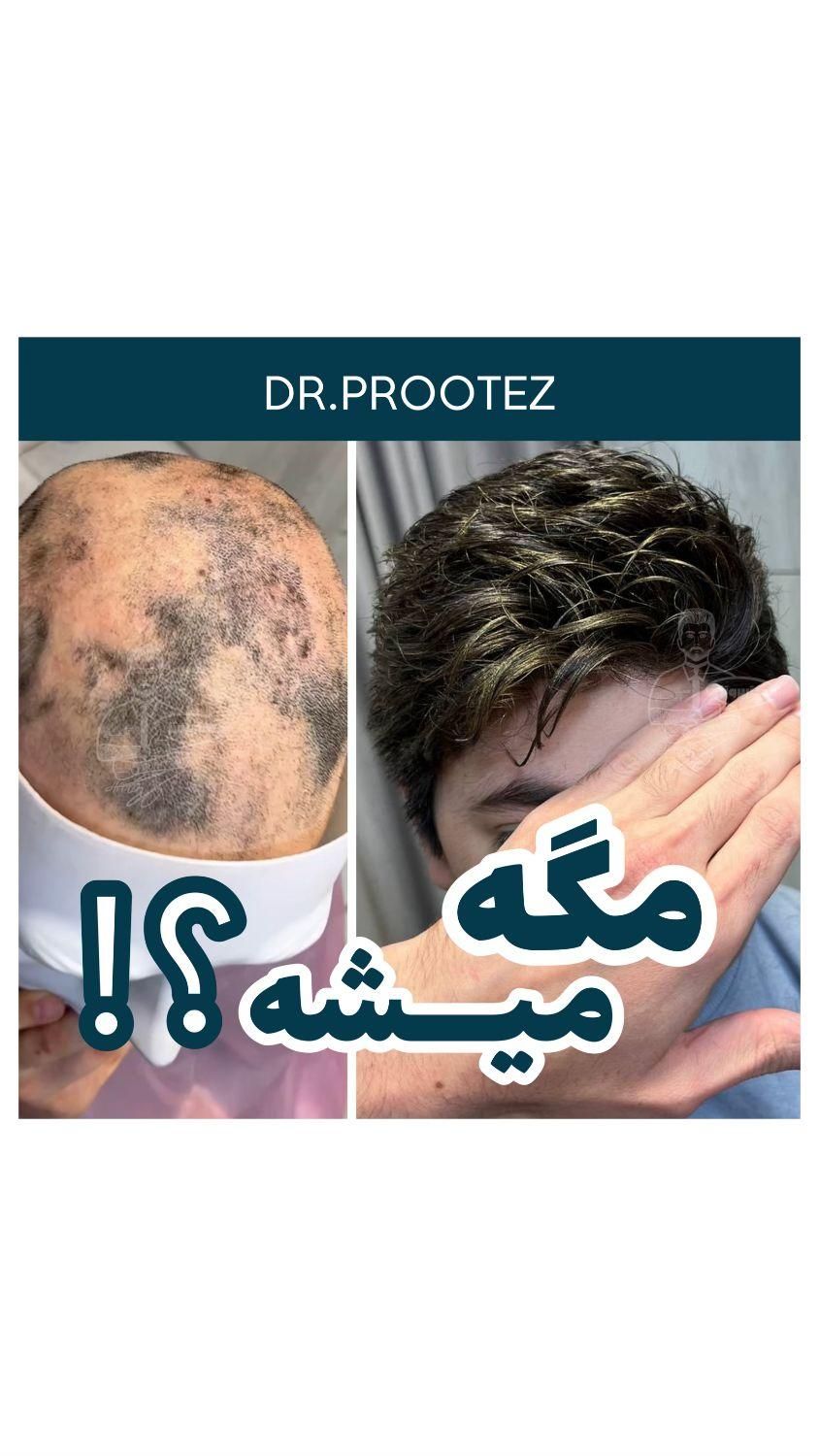 پروتزمو (دکترپروتز)|خدمات آرایشگری و زیبایی|اصفهان, هزارجریب|دیوار