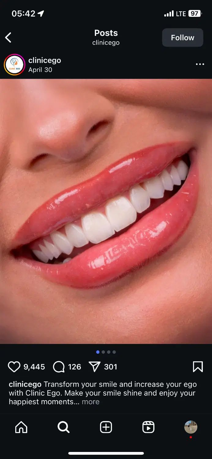 ایمپلنت عصبکشی ترمیم کشیدن|خدمات آرایشگری و زیبایی|تهران, دزاشیب|دیوار