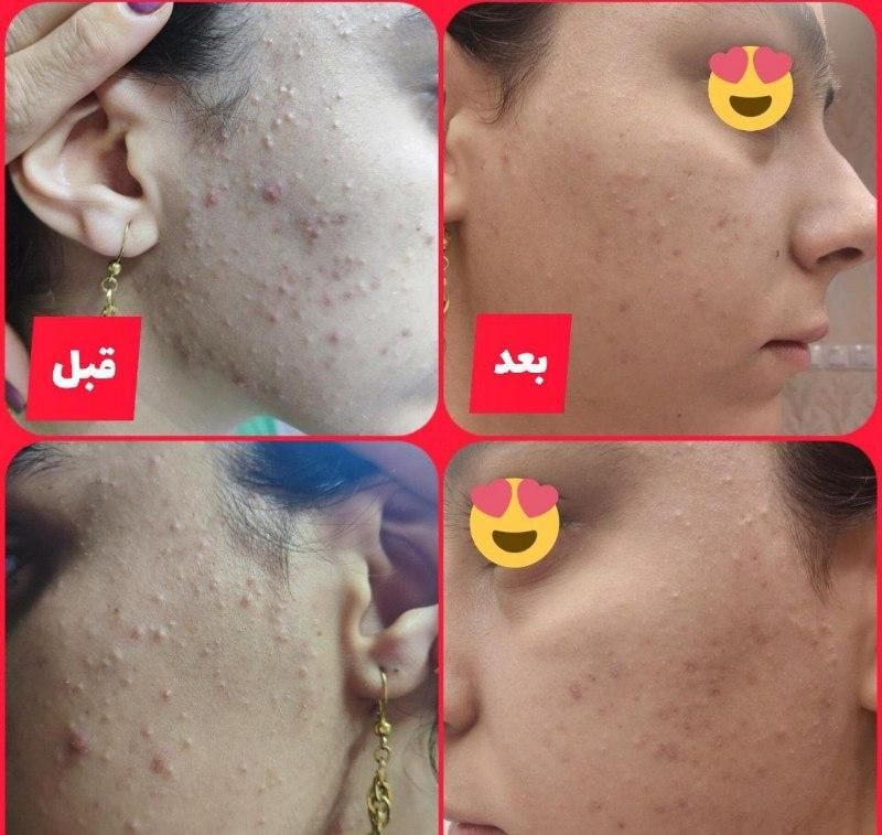 کرم ترمیم کننده گاتیو 40ml|آرایشی، بهداشتی، درمانی|تهران, تهرانسر شرقی|دیوار