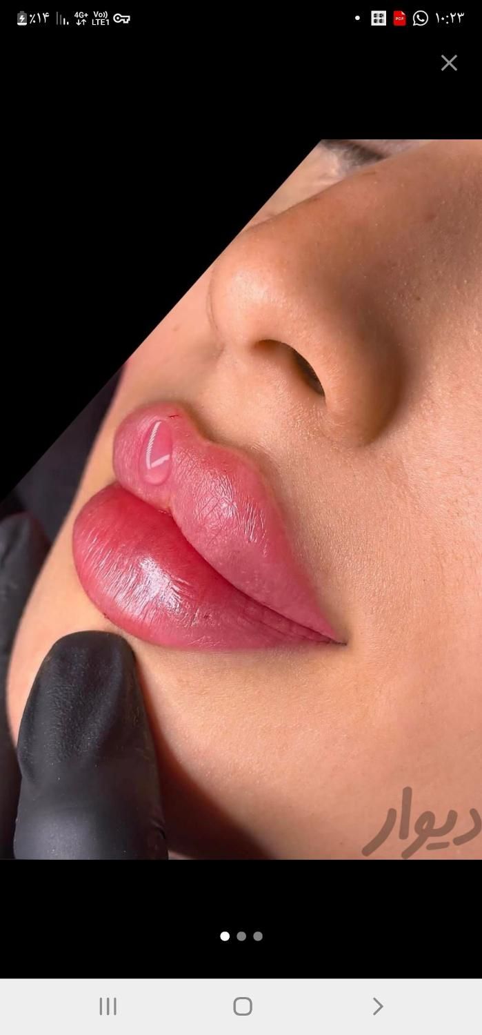 تزریق ژل وبوتاکس وپی آر پی با قیمت های باور نکردنی|خدمات آرایشگری و زیبایی|اصفهان, شمس آباد|دیوار