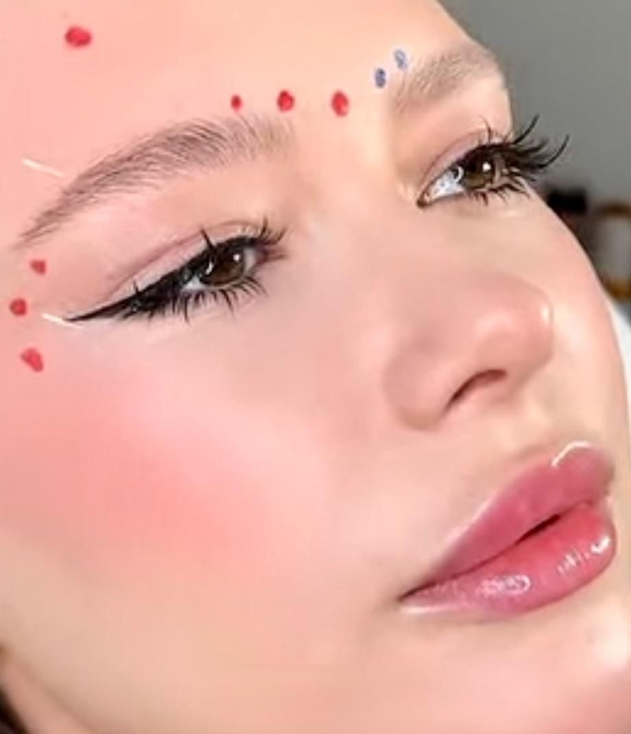 جشنواره ای ژل و بوتاکس فیلر و لیزر|خدمات آرایشگری و زیبایی|تبریز, |دیوار