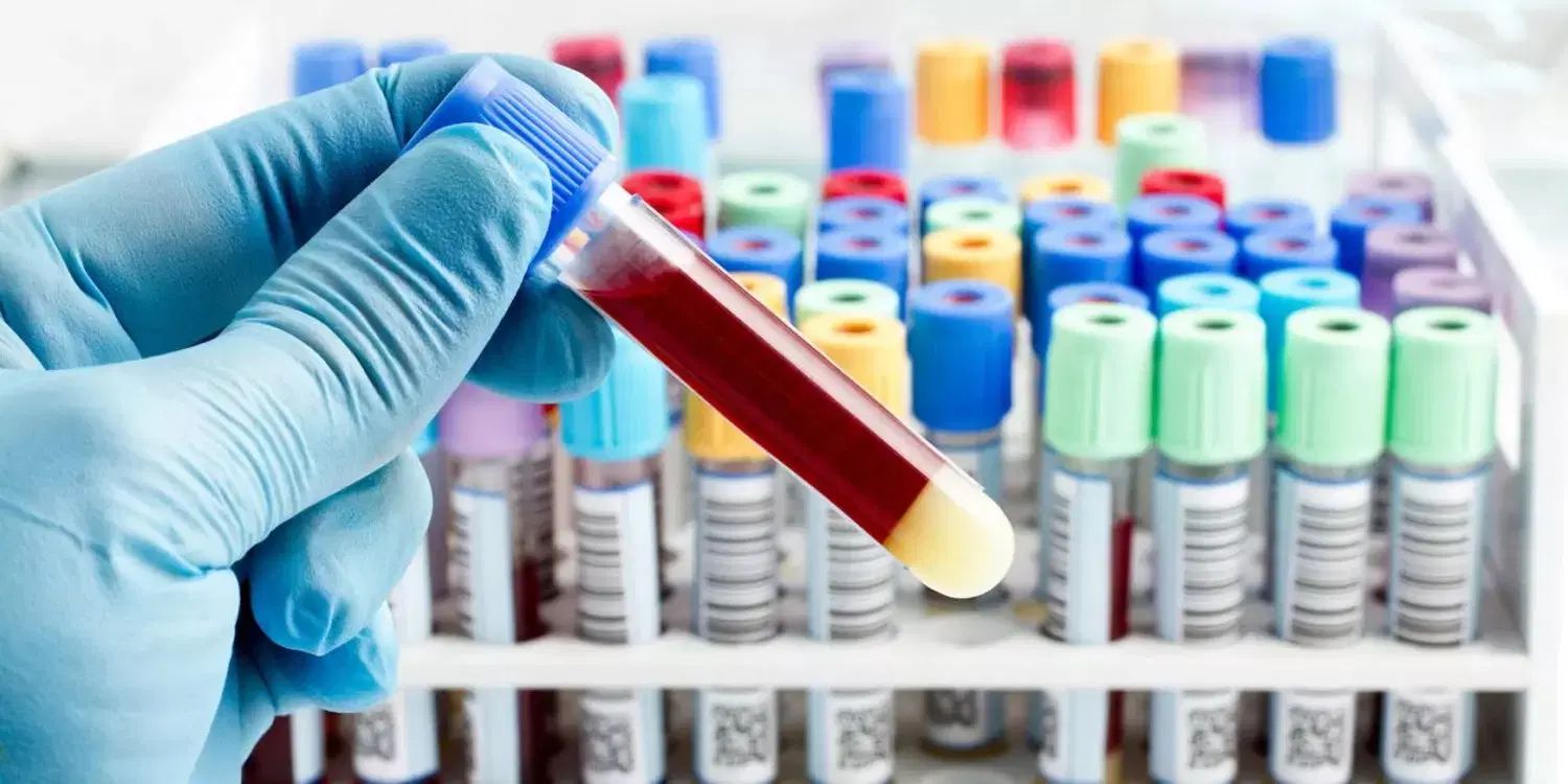 آموزش صفر تا صد کار در آزمایشگاه تشخیص طبی|خدمات آموزشی|تبریز, |دیوار