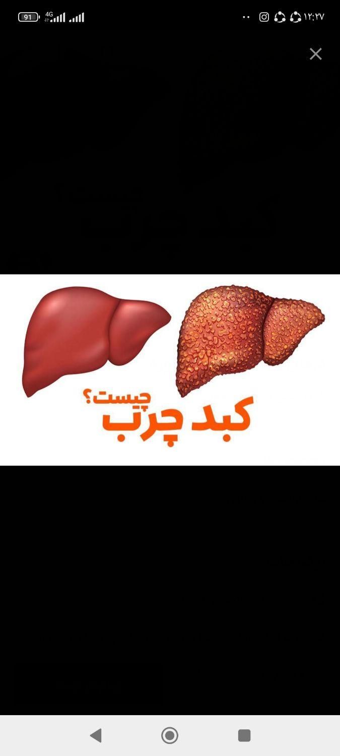 درمان کبد چرب|خدمات آرایشگری و زیبایی|گنبد کاووس, |دیوار