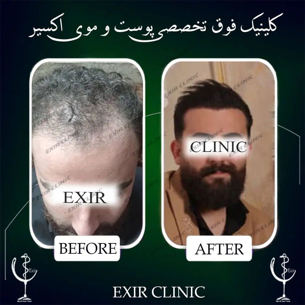 استخدام مشاور و مدیر داخلی خانم جهت کلنیک کاشت مو|استخدام درمانی، زیبایی، بهداشتی|تهران, جردن|دیوار