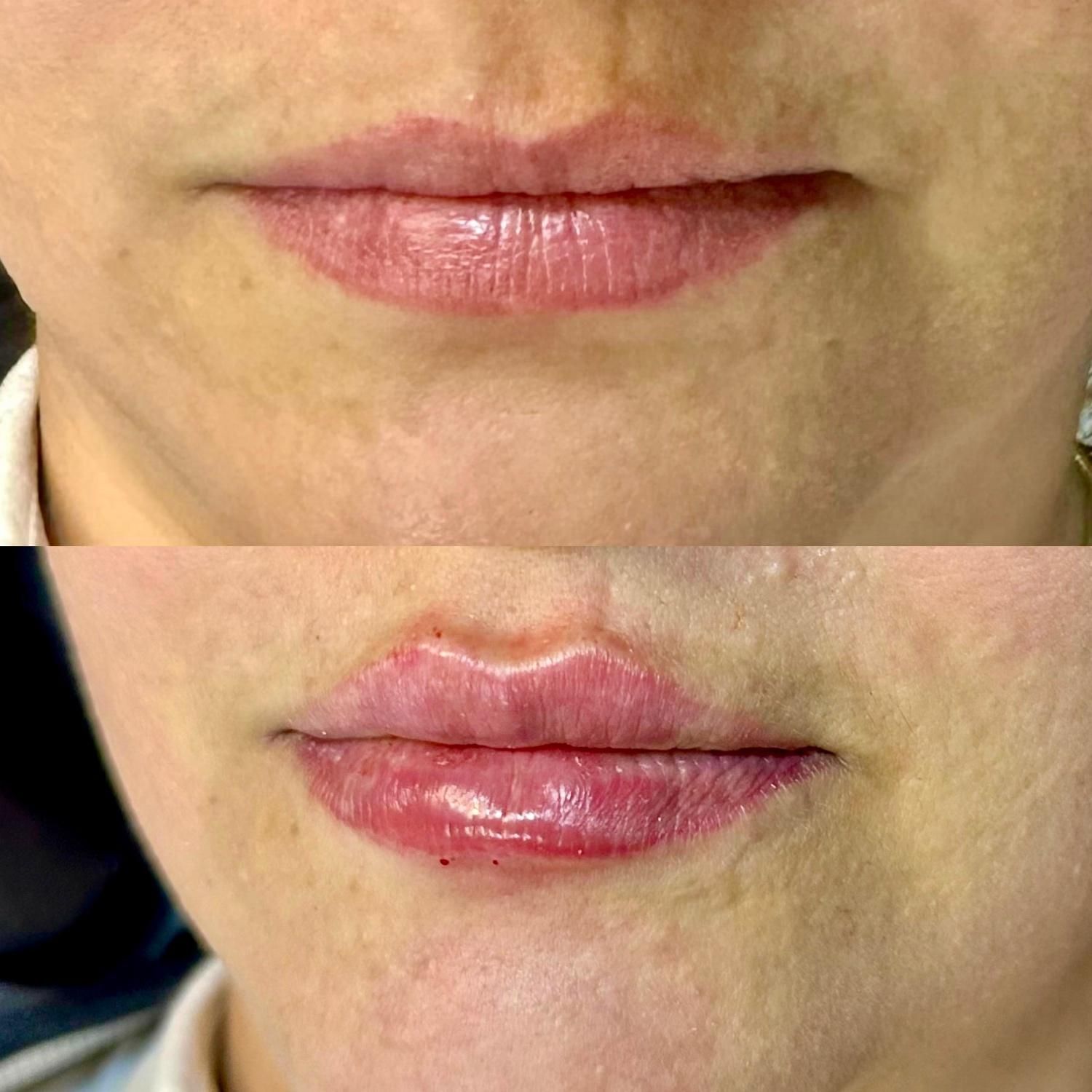 فیلر لب/کانتورینگ کامل صورت /فیلر بکینی/بوتاکس|خدمات آرایشگری و زیبایی|اصفهان, گلزار|دیوار