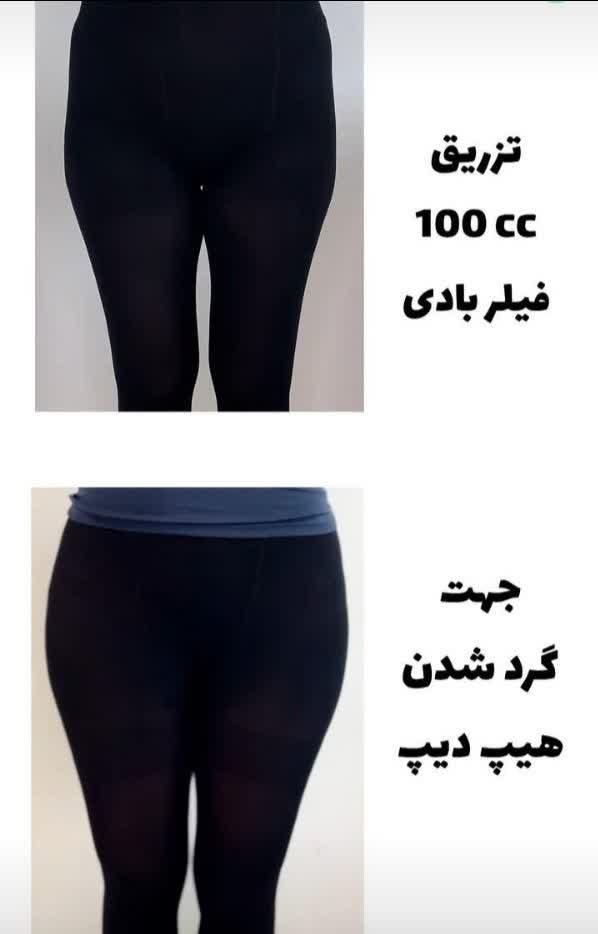 فیلر شقیقه فیلر زیر چشم نخ لیفت ابرو و چشم گربه ای|خدمات آرایشگری و زیبایی|قم, زنبیل آباد|دیوار