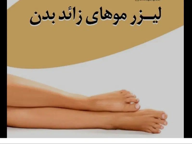 لیزرموهای زائد.جوابدهی بالاوقیمت اقتصادی|خدمات آرایشگری و زیبایی|زابل, |دیوار