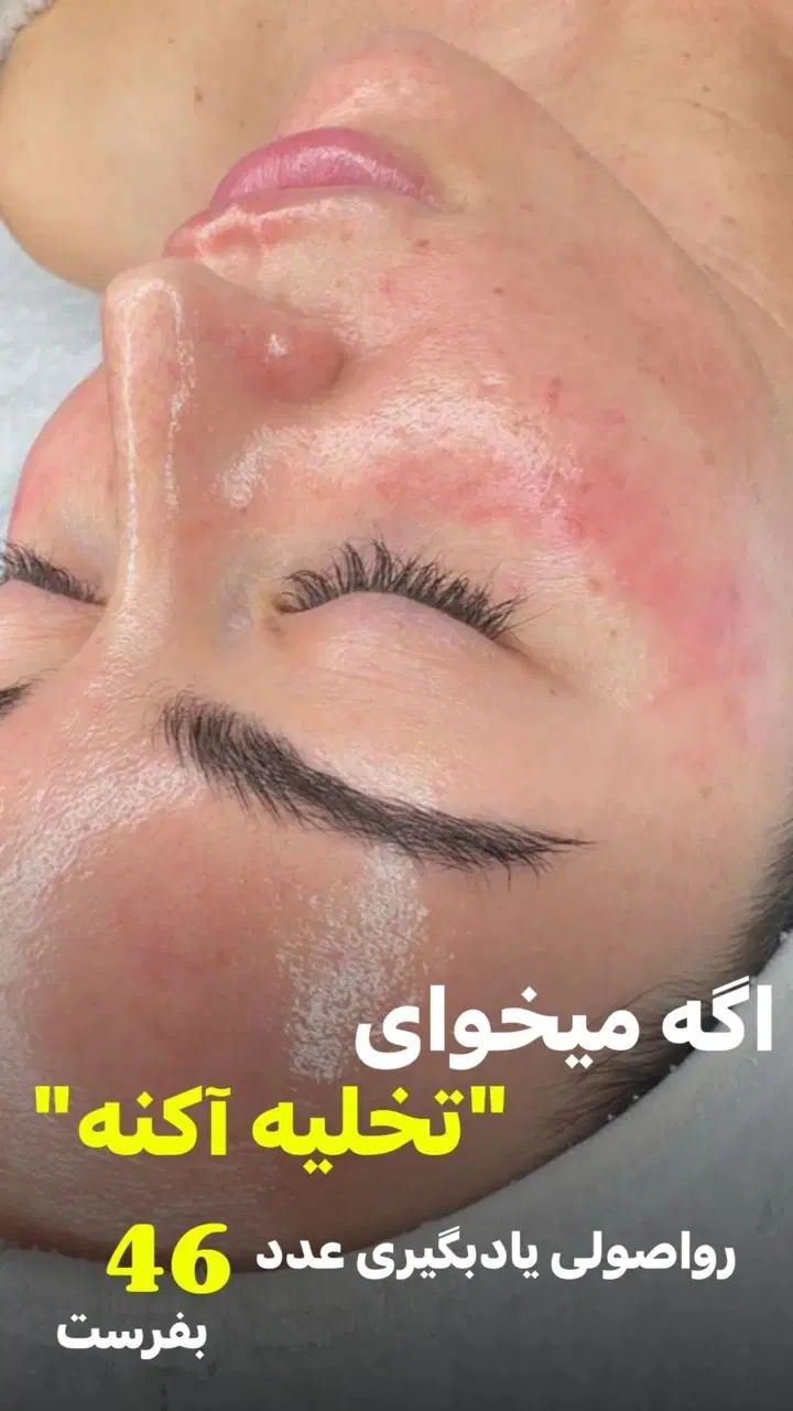 پاکسازی پوست با بهترین متریال و کمترین هزینه|خدمات آرایشگری و زیبایی|آبادان, |دیوار