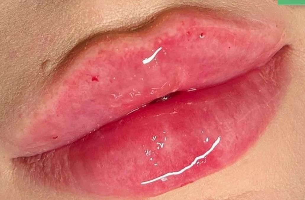 اموزش ویژه ژل و بوتاکس|خدمات آرایشگری و زیبایی|اصفهان, جامی|دیوار