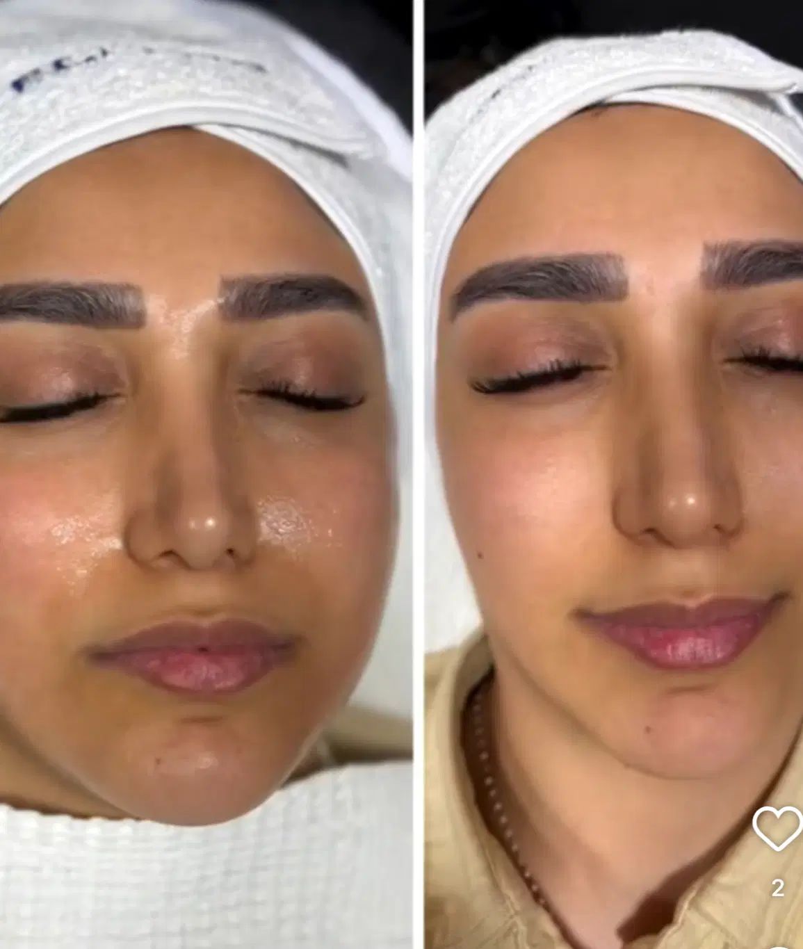 دوره تخصصی آموزش مزوژل و جوانسازی پوست و پاکسازی|خدمات آموزشی|تهران, چیتگر جنوبی|دیوار