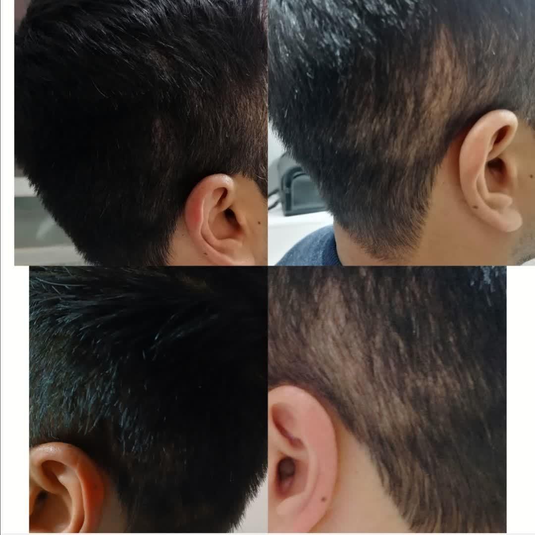 آموزش خدمات میکرواسکالپ کاشت اسکالپ مو تضمینی|خدمات آرایشگری و زیبایی|مشهد, جانباز|دیوار