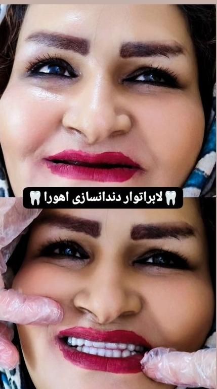 دندان ،دندان سازی ،دندان مصنوعی ،جوان پسند،اقساطی|خدمات آرایشگری و زیبایی|مشهد, شاهد (شهرک غرب)|دیوار