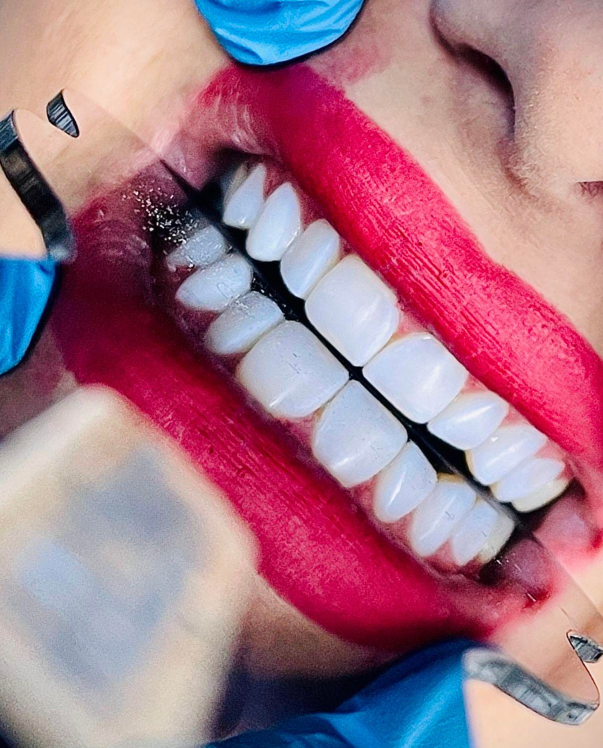 دندانپزشکی و کامپوزیت دندان و دندان مصنوعی|خدمات آرایشگری و زیبایی|تهران, بهداشت|دیوار