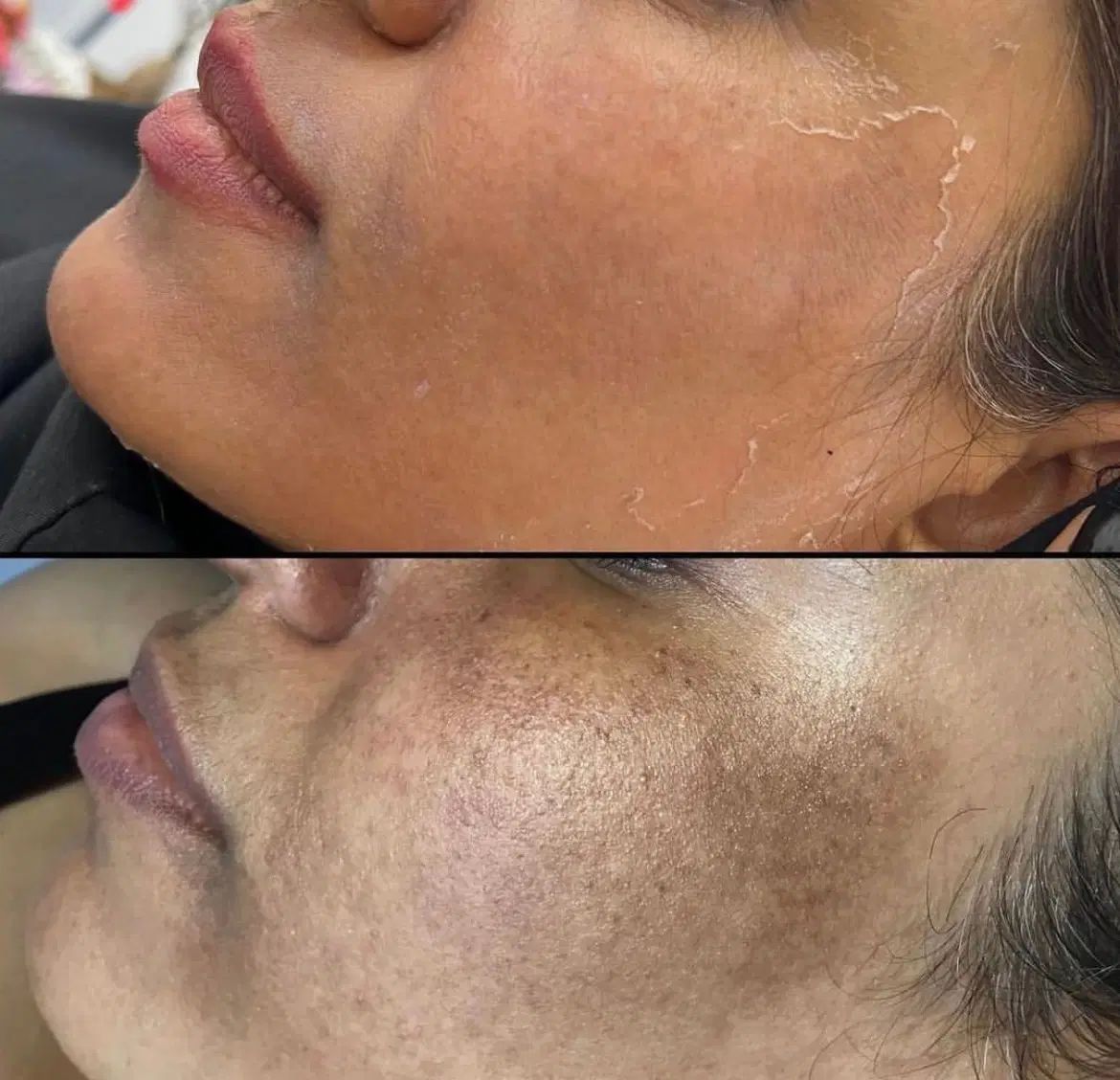 آموزش و خدمات تکنیک پوست مار و مزونیدلینگ|خدمات آرایشگری و زیبایی|اسلام‌شهر, باغ فیض|دیوار