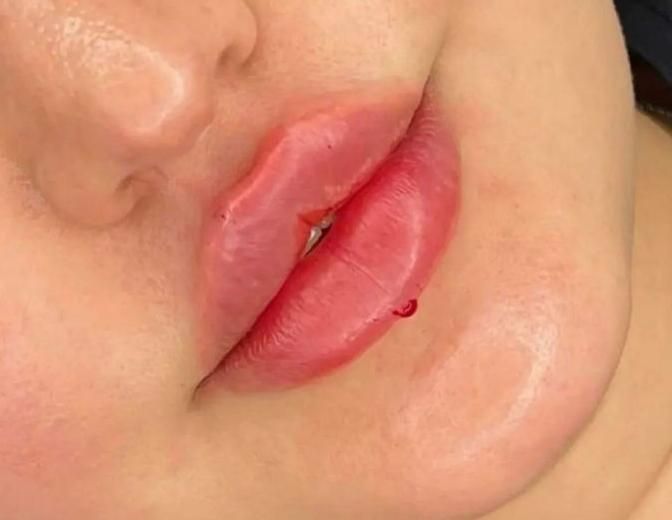 ژل فیلر آنزیم بوتاکس ناخن|خدمات آرایشگری و زیبایی|مرودشت, فرهنگ|دیوار