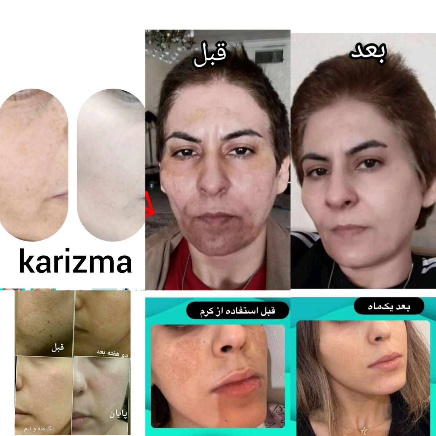 پک سفیدکننده ضدلک فوق حرفه ای کاریزماتیک|آرایشی، بهداشتی، درمانی|شیراز, سیاه سنگ|دیوار