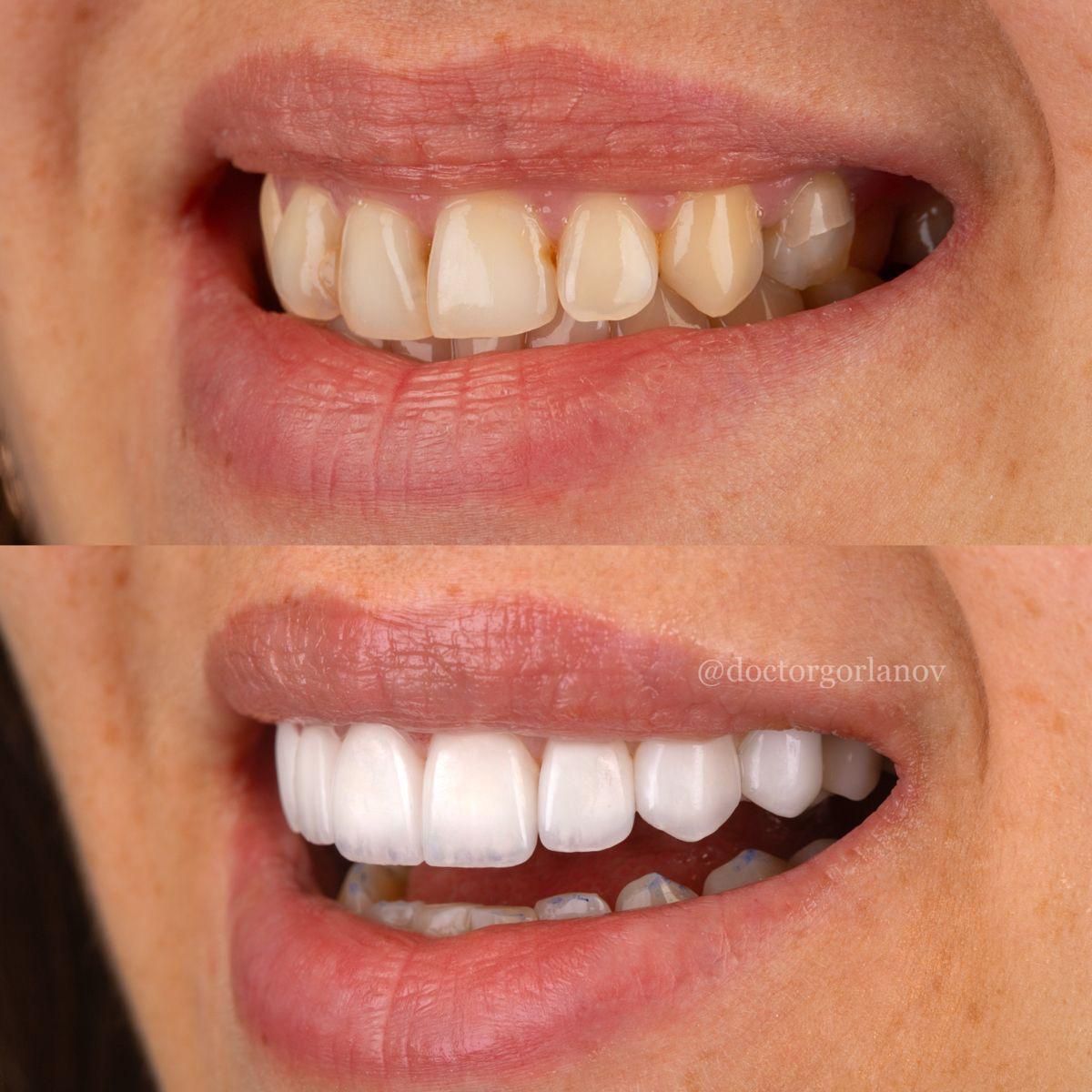 دندانپزشکی/لمینیت/ایمپلنت ( نصف قیمت تعرفه )|خدمات آرایشگری و زیبایی|تهران, فلسطین (میدان انقلاب)|دیوار