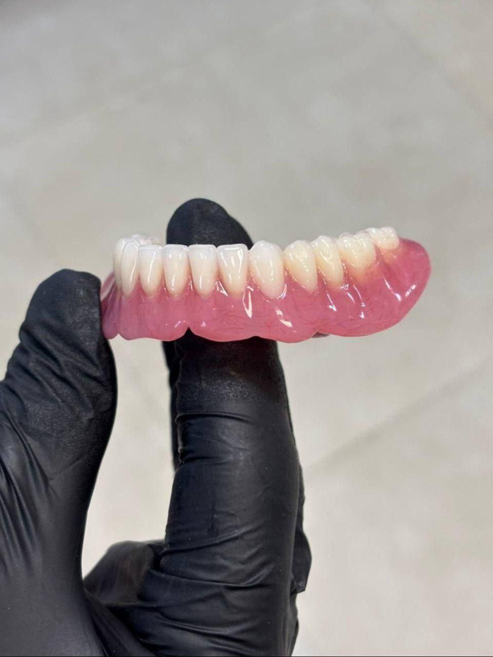 دندانپزشک و دندانساز تجربی|خدمات آرایشگری و زیبایی|ابهر, |دیوار