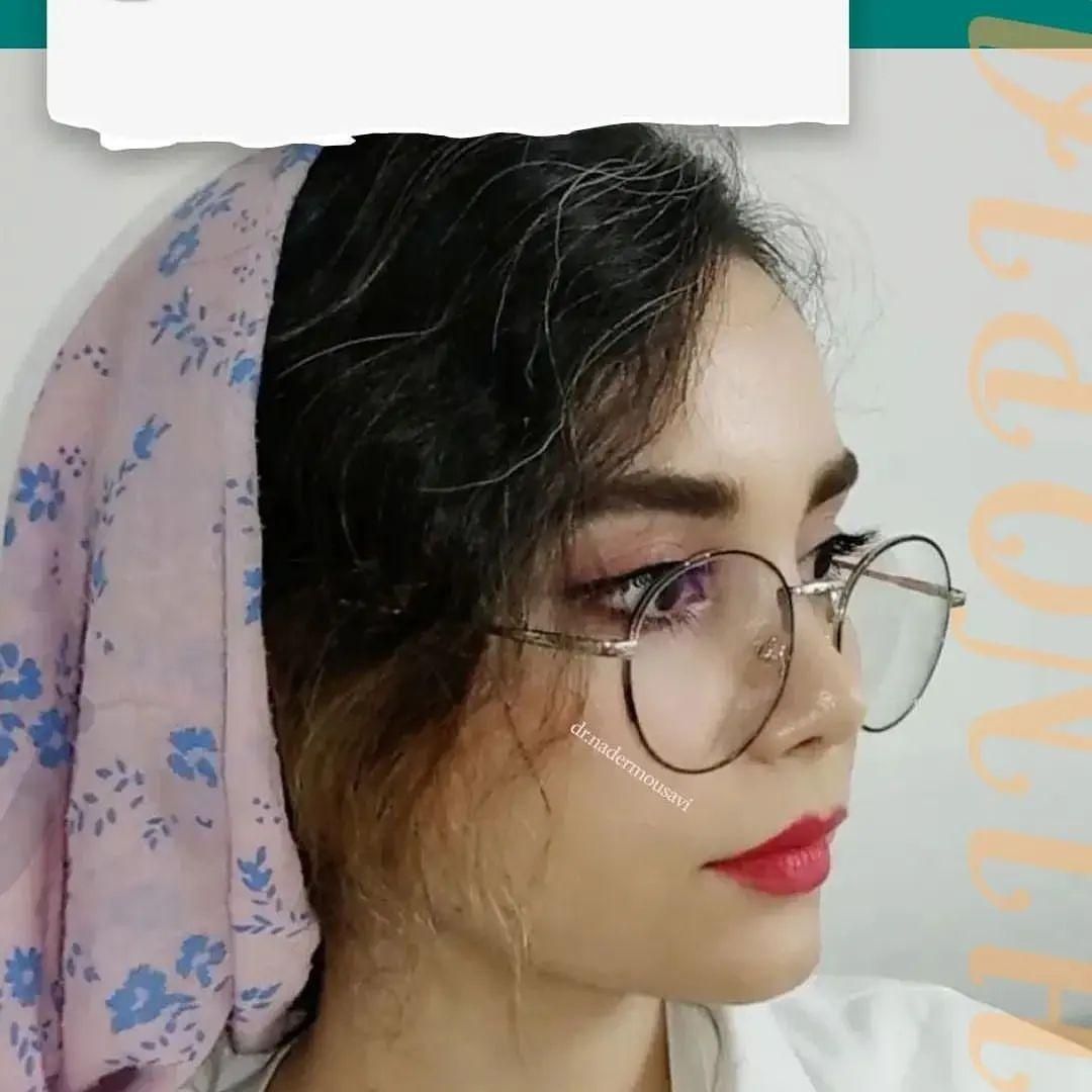 جراحی زیبایی بینی ،گچساران،دکتر نادر موسوی|خدمات آرایشگری و زیبایی|دوگنبدان, |دیوار