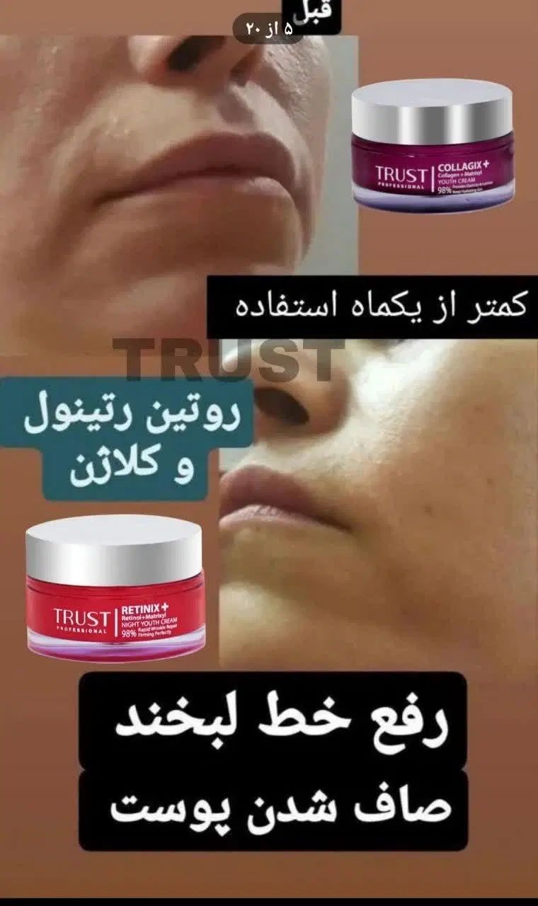 روتین روتینول وکلاژن|آرایشی، بهداشتی، درمانی|تهران, جردن|دیوار