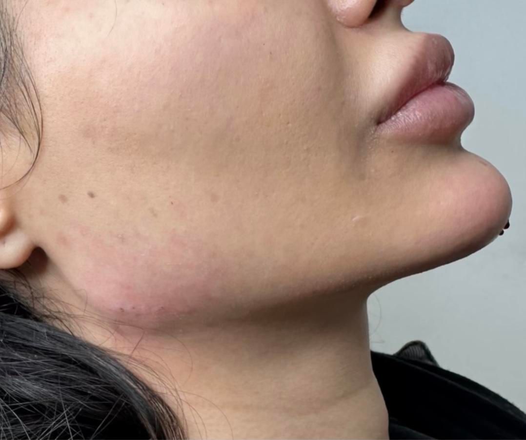 جشنواره مدلینگ ۱۰ سی سی امروز۳۳۰۰فیلر لب لیفت ابرو|خدمات آرایشگری و زیبایی|تهران, مرزداران|دیوار