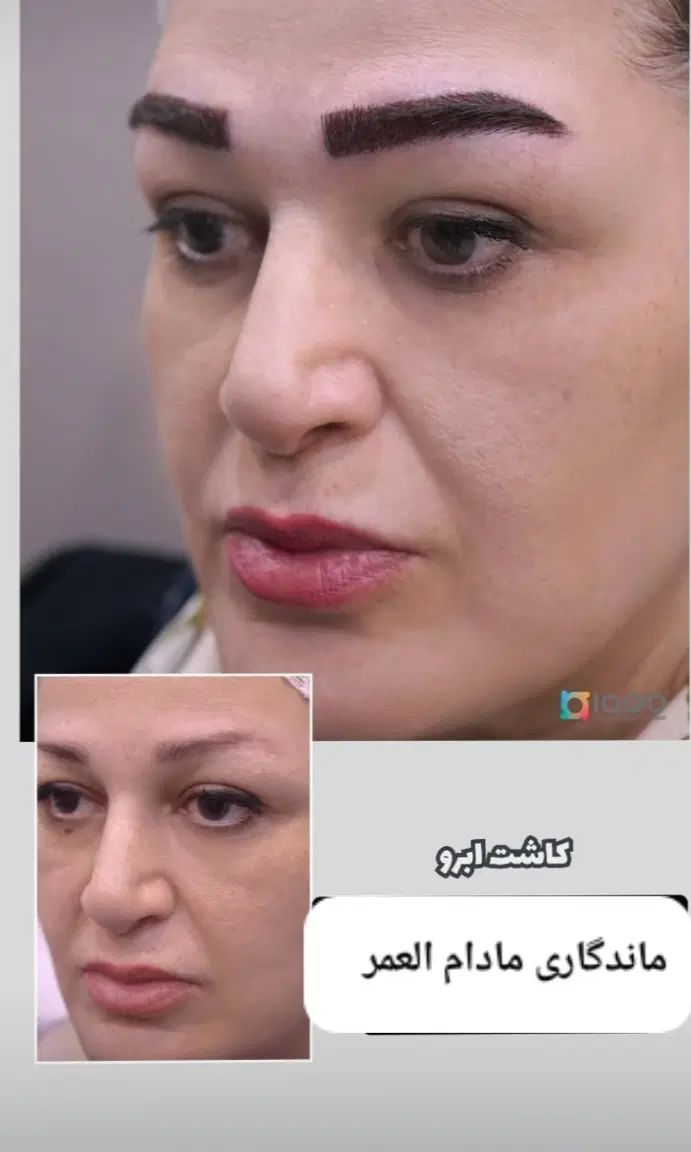 کاشت مووابروباتراکم بالا /طبیعی /اقساطی وتضمینی|خدمات آرایشگری و زیبایی|تهران, سعادت‌آباد|دیوار