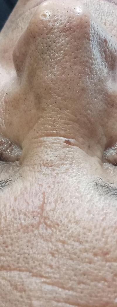 اف ویژه پاکسازی فیشیال*vip* تخصصی درمانی|خدمات آرایشگری و زیبایی|یاسوج, |دیوار