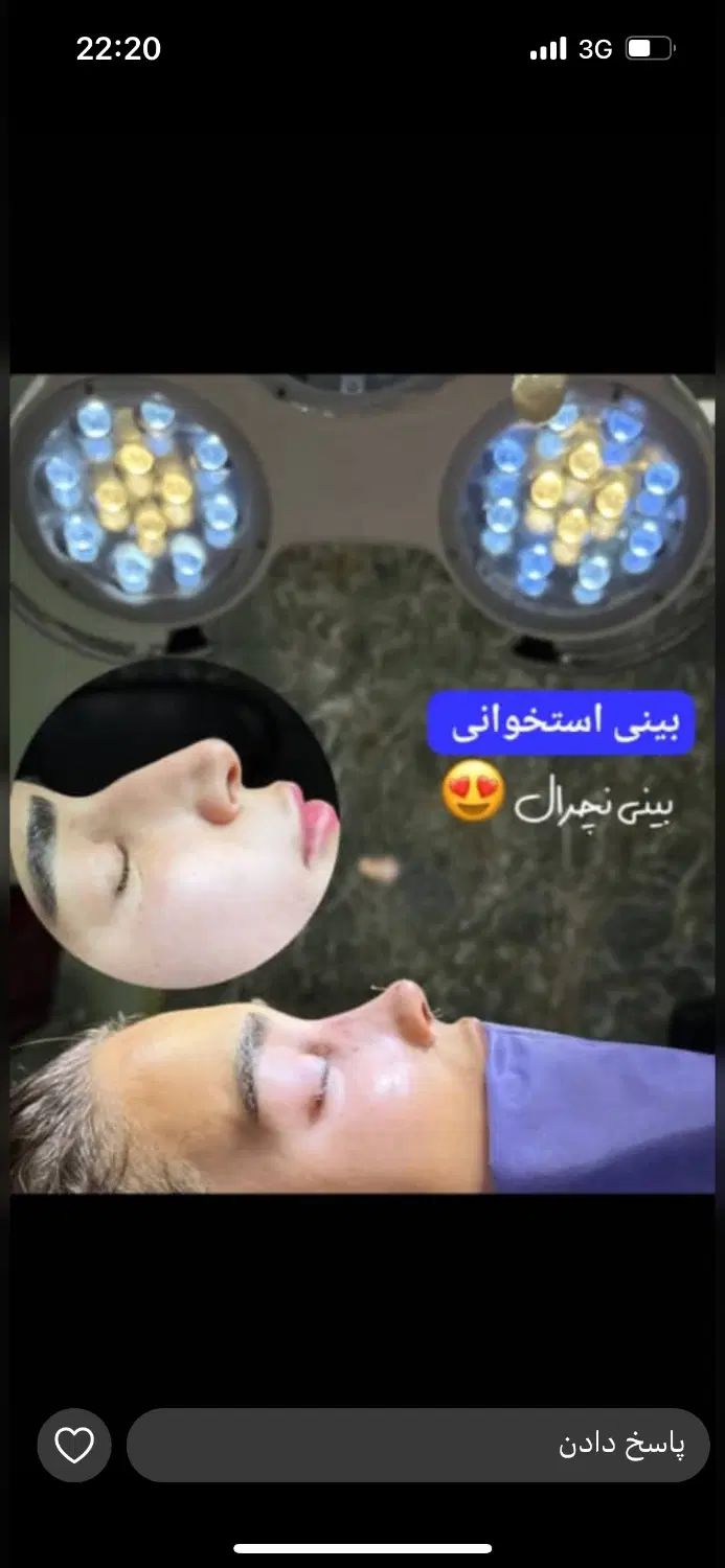 تخفیف لیپو ابدو ۱۱تومن رینوعمل بینی|خدمات آرایشگری و زیبایی|تهران, آهنگ|دیوار