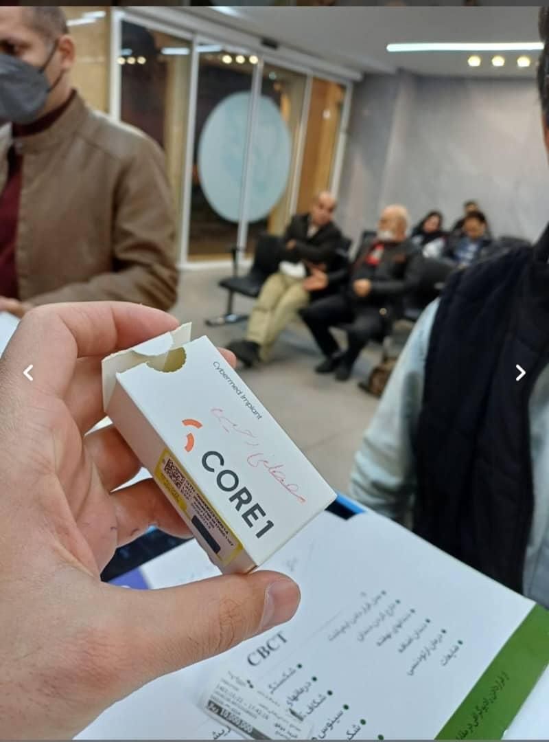 ایمپلنت فقط هفت میلیون و نهصد ضمانتی|خدمات آرایشگری و زیبایی|رشت, گلسار|دیوار