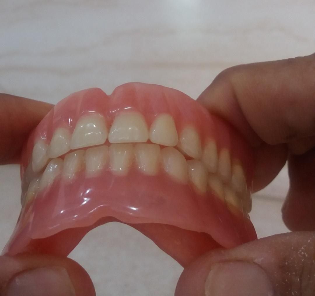 ساخت دندان مصنوعی متحرک|خدمات آرایشگری و زیبایی|صدرا-فارس, |دیوار