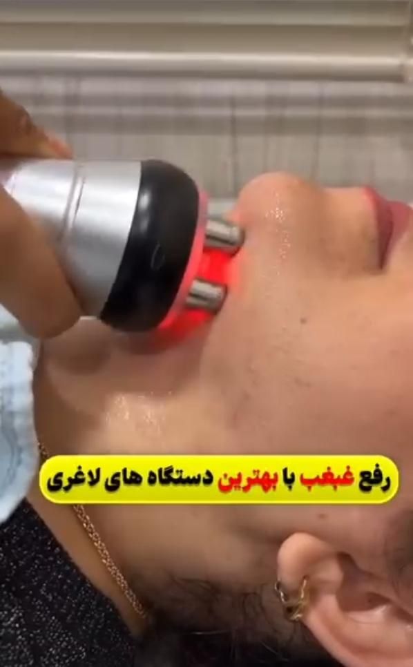 لاغری و کاهش سایز تضمینی بادستگاه کوویتیشن آرآف|خدمات آرایشگری و زیبایی|کرج, گوهردشت|دیوار
