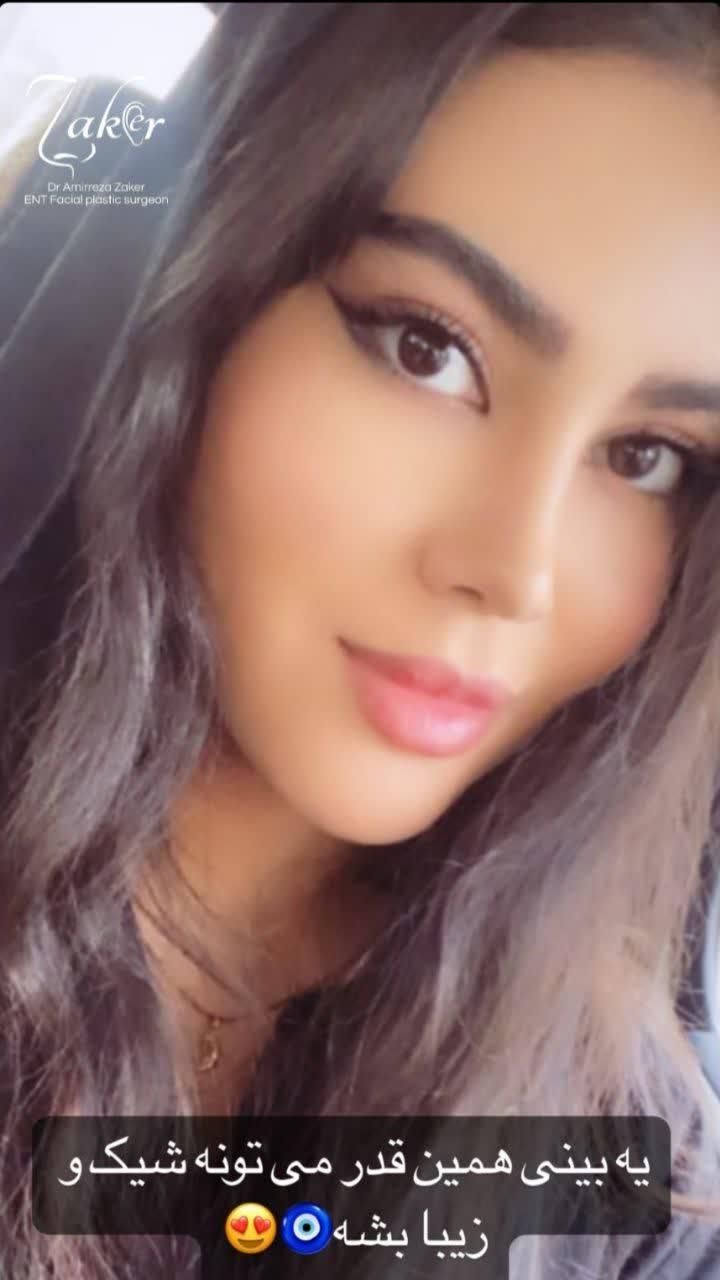 جراحی و عمل زیبایی بینی/ پیکرتراشی|خدمات آرایشگری و زیبایی|کرج, عظیمیه|دیوار