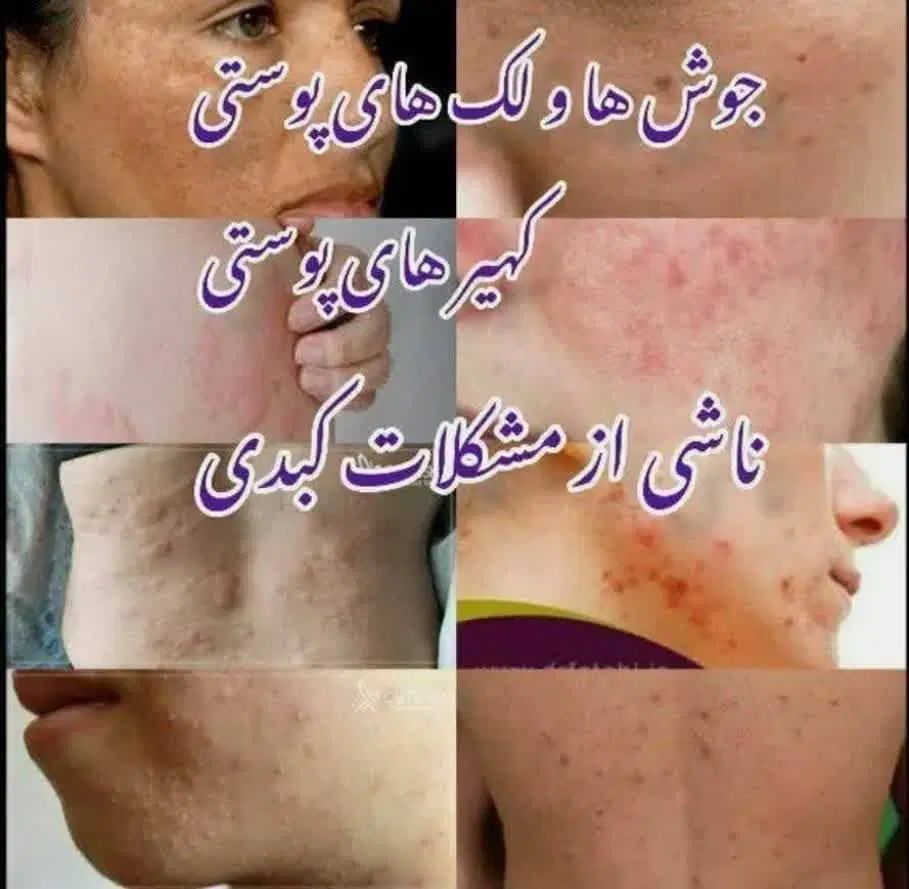 درمان‌بیماری‌ودرمان‌کبدچرب‌بامعجزه‌روغن‌ ها|خوردنی و آشامیدنی|اصفهان, ملک‌شهر|دیوار