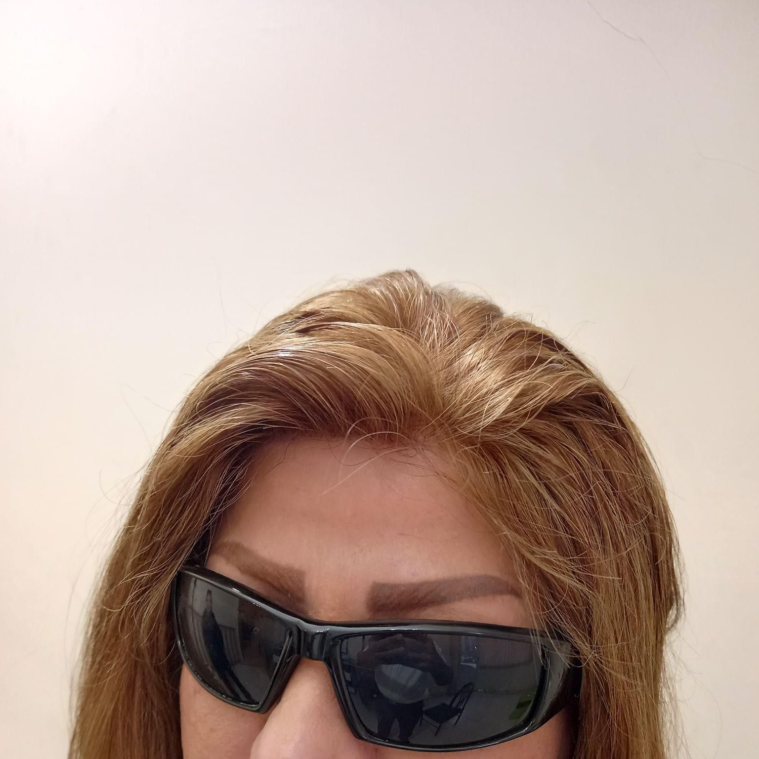 پروتز مو و ترمیم موی شقایق. چسب پروتز|خدمات آرایشگری و زیبایی|تبریز, |دیوار