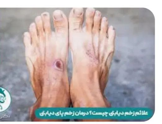 بهبود کامل دیابت به روش های کاملاً گیاهی وتضمینی|خدمات آرایشگری و زیبایی|گنبد کاووس, |دیوار