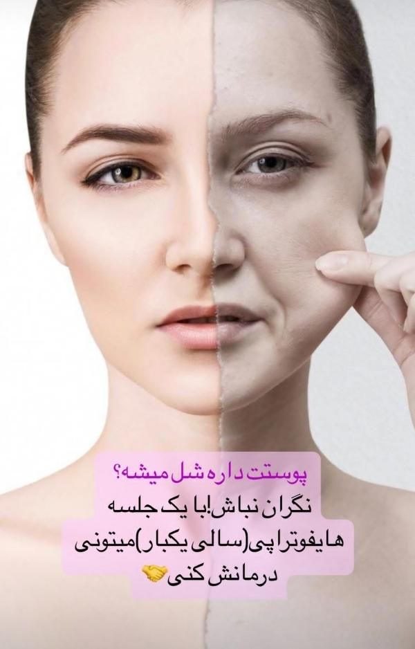 مرکز هایفو اورجینال اصفهان|خدمات آرایشگری و زیبایی|اصفهان, مسجد مصلی|دیوار