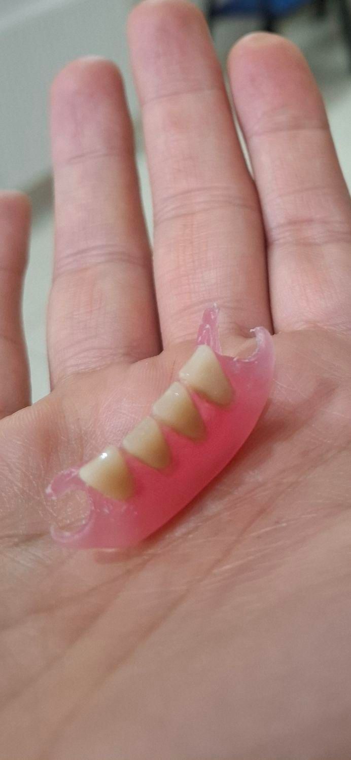 دندان مصنوعی بدون سقف*فلکسیبل*جایگزین ایمپلنت|خدمات آرایشگری و زیبایی|ری, دولتآباد|دیوار