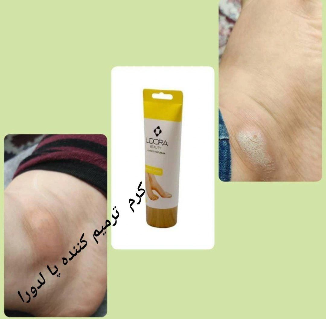 کرم ترک پای قوی لدورا ترمیم سریع ترک و خشکی|آرایشی، بهداشتی، درمانی|لاهیجان, شهید آوینی|دیوار