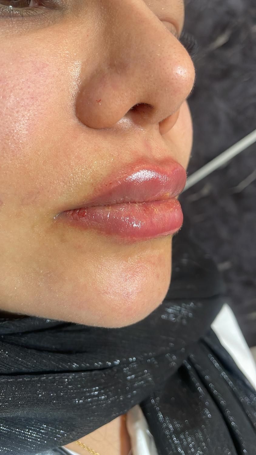 کرمپودر دائم و ژل و بوتاکس و هایفو|خدمات آرایشگری و زیبایی|اهواز, کیانپارس |دیوار