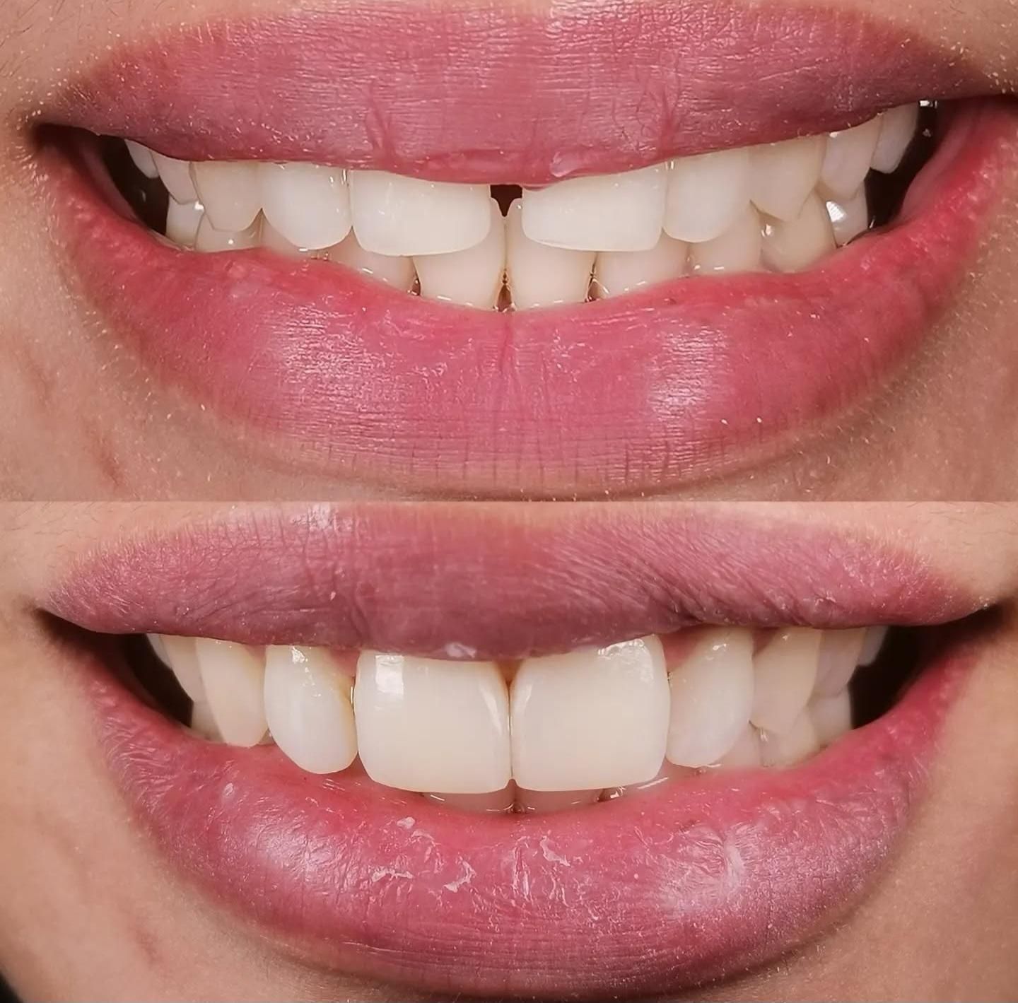 دندانپزشکی گران نیست، غفلت گران است(نقد اقساط)|خدمات آرایشگری و زیبایی|شیراز, گلدشت معالی‌آباد|دیوار