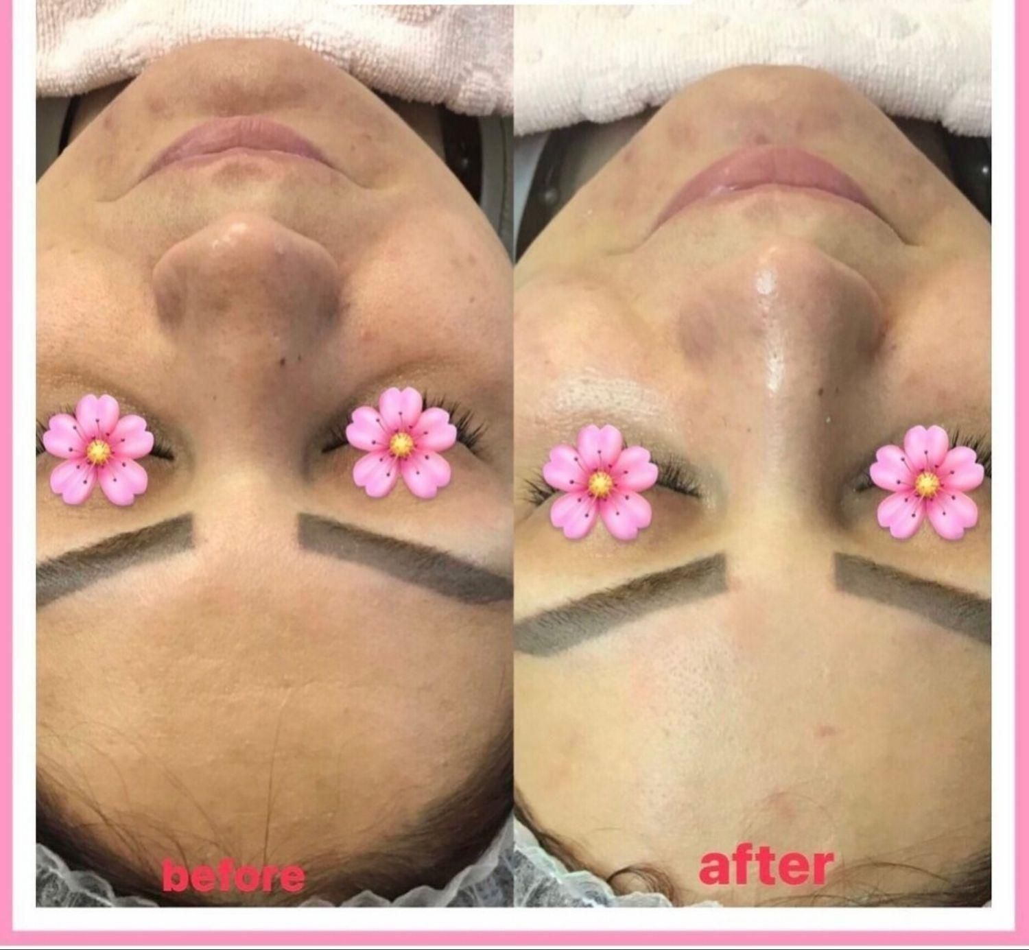 فیشال تخصصی و درمانی قم|خدمات آرایشگری و زیبایی|قم, زنبیل آباد|دیوار