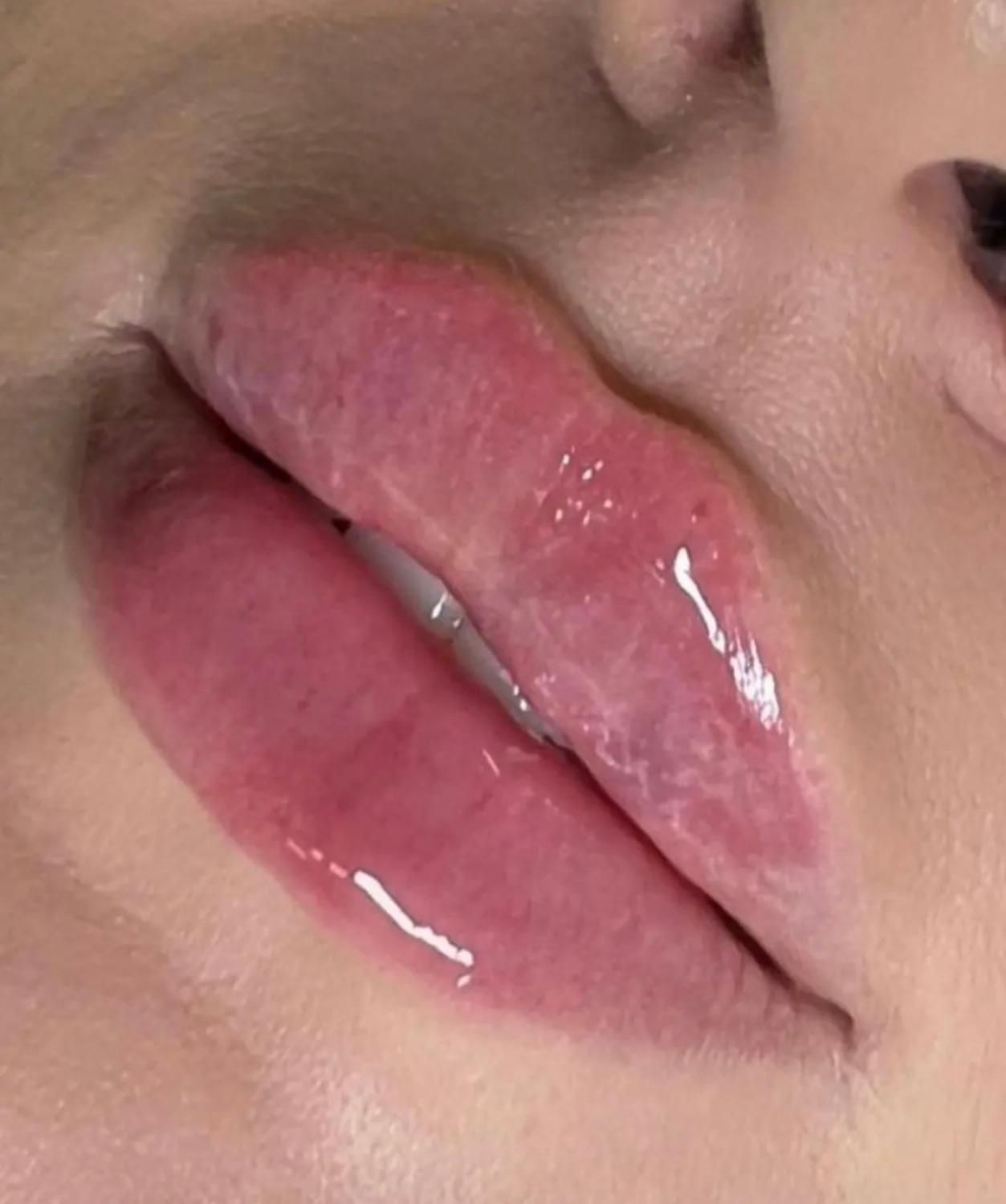 خدمات ژل و بوتاکس ، مزوتراپی سر و صورت|خدمات آرایشگری و زیبایی|شاهینشهر, فردوسی|دیوار