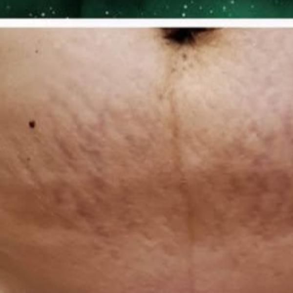 فقط قبل بعد درمان سخت ترین مشکلات پوستی|آرایشی، بهداشتی، درمانی|تهران, اوقاف|دیوار
