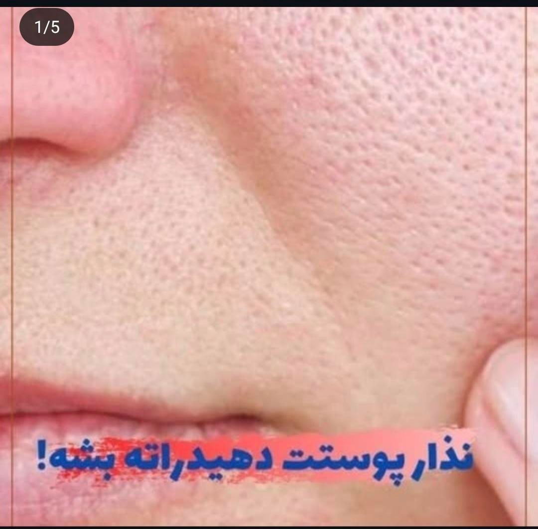 پاکسازی با.  70٪  تخفیف قیمت 120 بمدت یکماه|آرایشگاه و سالن‌های زیبایی|اصفهان, آزادگان|دیوار