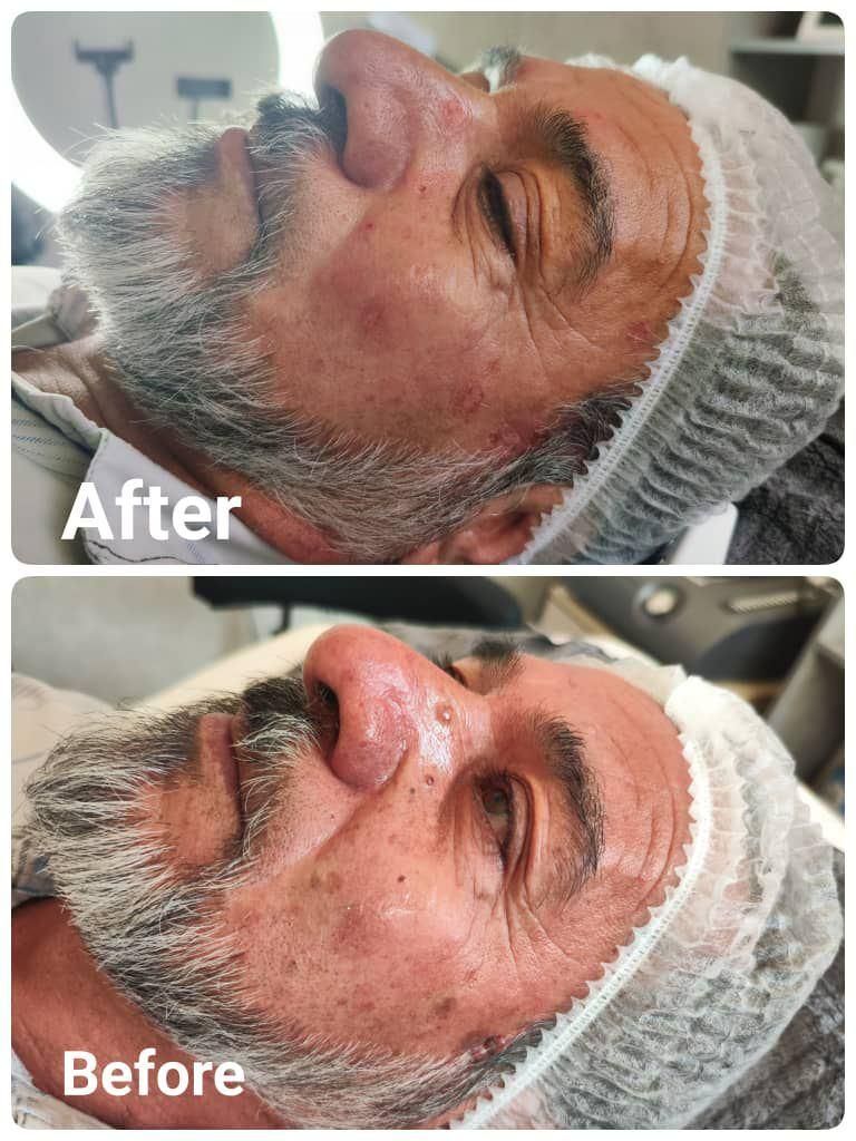 خال برداری/کک و مک/منگوله/ماه گرفتگی/روشن سازی|خدمات آرایشگری و زیبایی|شیراز, کوی زهرا|دیوار